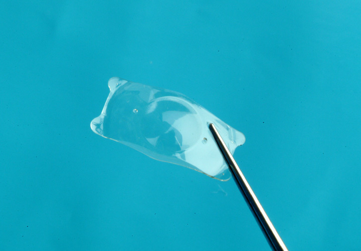 ICL = Implantable Collamer Lens